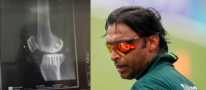 shoaib-akhtar-to-undergo-knee-replacement-surgery