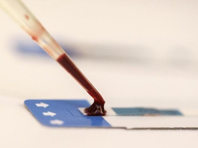 on-the-cusp-national-institute-of-virology-to-develop-its-own-coronavirus-diagnostic-kit
