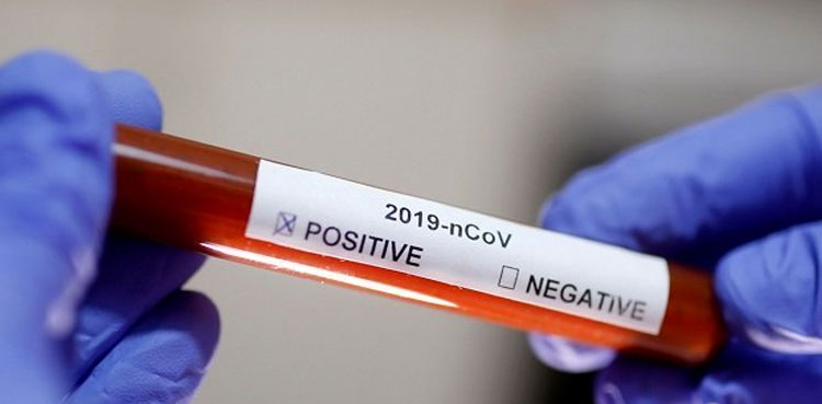pakistan-records-3369-fresh-coronavirus-cases-and-72-deaths
