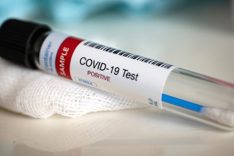 pakistan-reports-63-coronavirus-related-deaths-in-past-24-hours