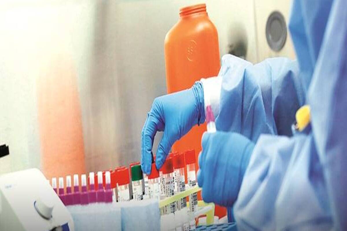 unicef-to-provide-1-15-mln-corona-testing-kits-to-pakistan