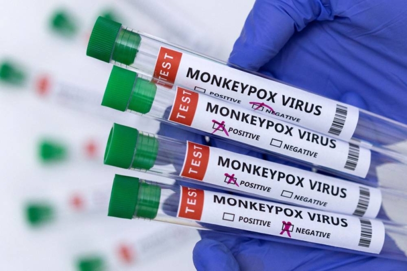 canada-reports-15-cases-of-monkeypox-more-expected