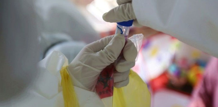 who-names-deadly-virus-from-china-as-covid-19