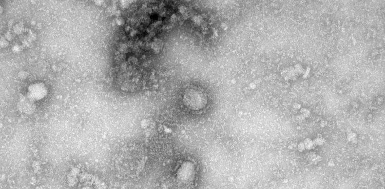 coronavirus-spreads-in-china-prisons